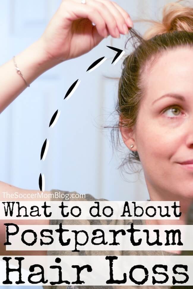If you see a lot of hair falling out after pregnancy, you're not alone! Postpartum hair loss is a common after-effect of giving birth. Here's how to deal...